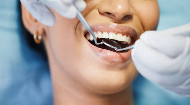Best Knocked-Out Tooth Emergency  in Springdale, SC