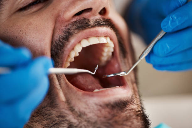 Best Broken Tooth Emergency  in Springdale, SC